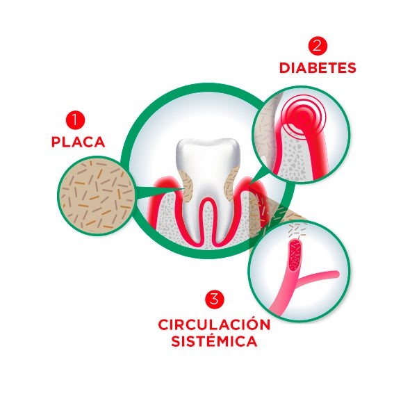 esquema sobre problemas dentales